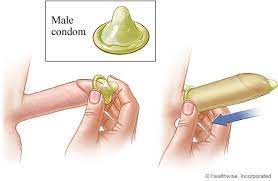 male-condom