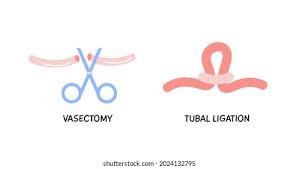 sterilization